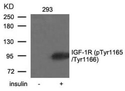 IGF-I R/IGF1R, p Tyr1165, p Tyr1166 Antibody, Novus Biologicals:Antibodies:Primary